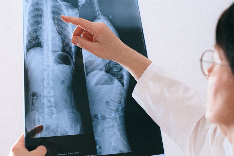 Physician reviewing a spinal X-ray, the kind of imaging that guides interventional pain procedures