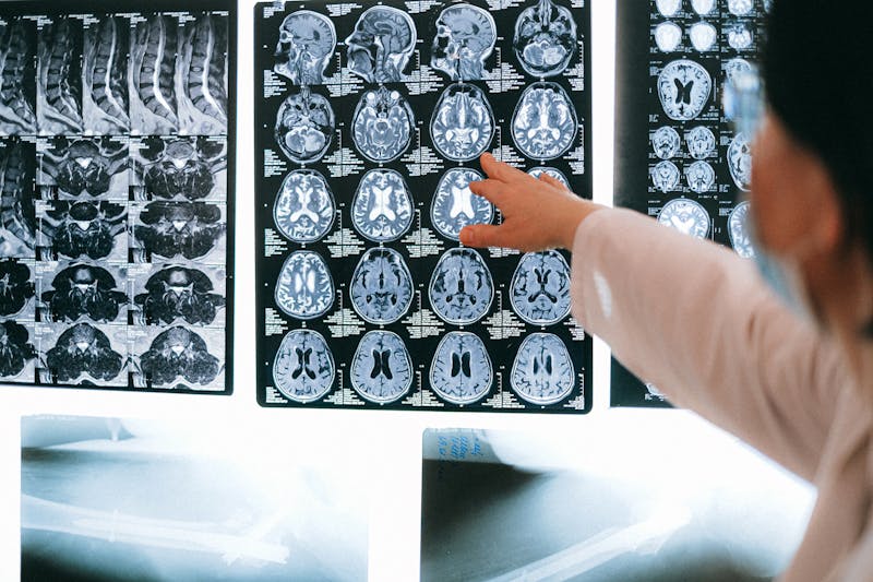 Radiologist examining MRI and CT brain scan images on light panel