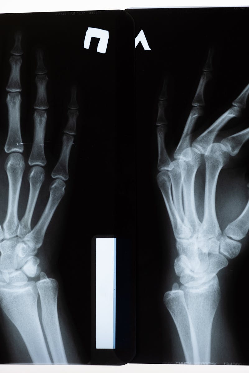 Diagnostic X-ray images of hand used in radiology billing